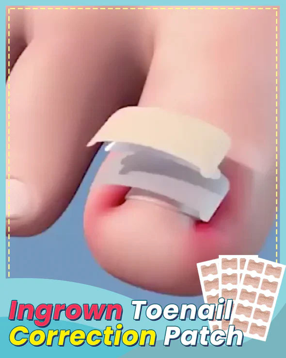 ToenailCorrector™ Patches