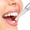 SparkleTooth™ - Teeth whitening pen【Last day discount】