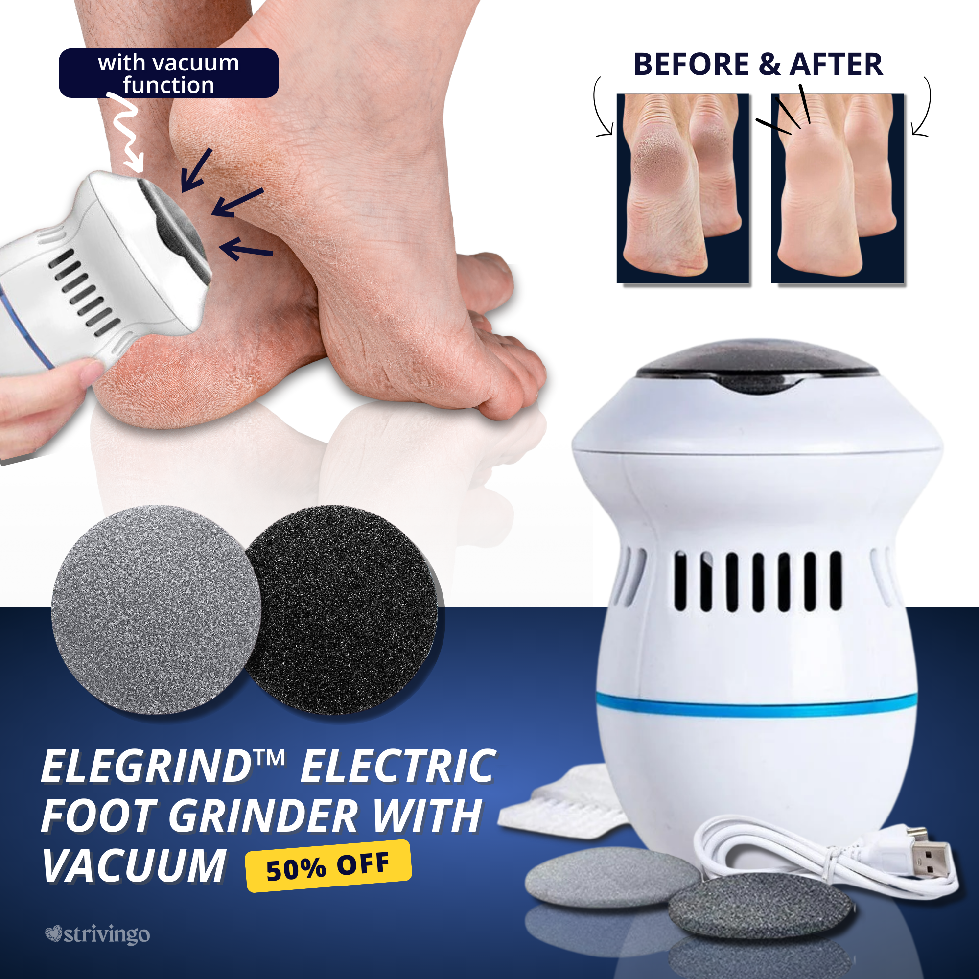 50% OFF THIS WEEK ONLY | Elegrind™ Electric Foot Grinder with Vacuum | incl. 2 Grinder Heads