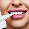 SparkleTooth™ - Teeth whitening pen【Last day discount】