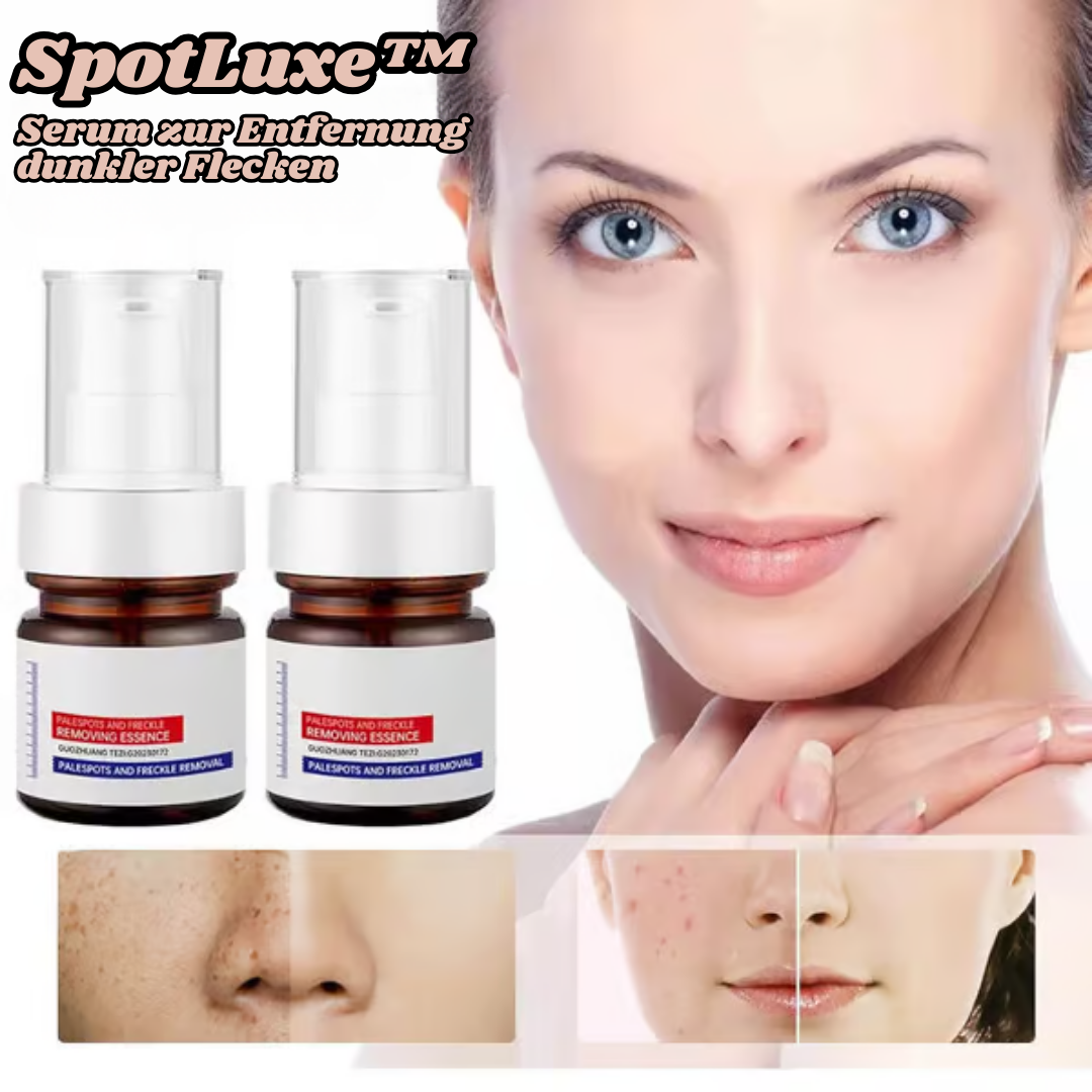 SpotLuxe - serum to remove dark spots